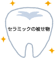 セラミックの被せ物 セラミックの被せ物